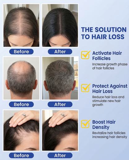 GHK-Cu Copper Peptide Hair Growth & Anti-Aging Serum